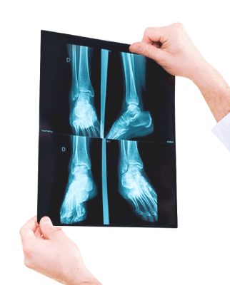 Консультация травматолога ортопеда